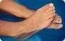 Pedicure