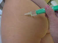 7_mesoterapia.jpg