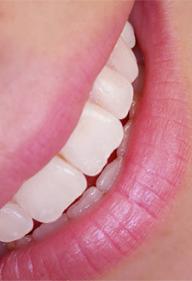 blanqueamientodental.jpg