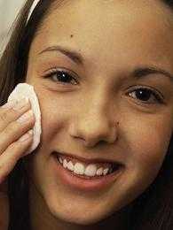 acne20anos