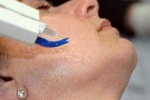 5mesoterapiafacial