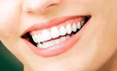 How to have white teeth