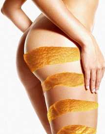 eliminarcelulitis