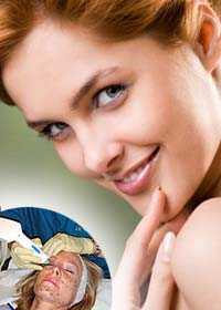 thermage2